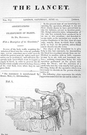 Lancet